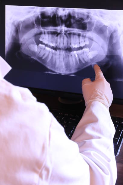 Best Emergency Dental Care for Broken or Chipped Teeth in Lake Park, FL